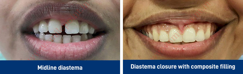 Aesthetic procedures