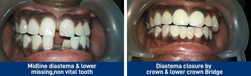 Aesthetic procedures