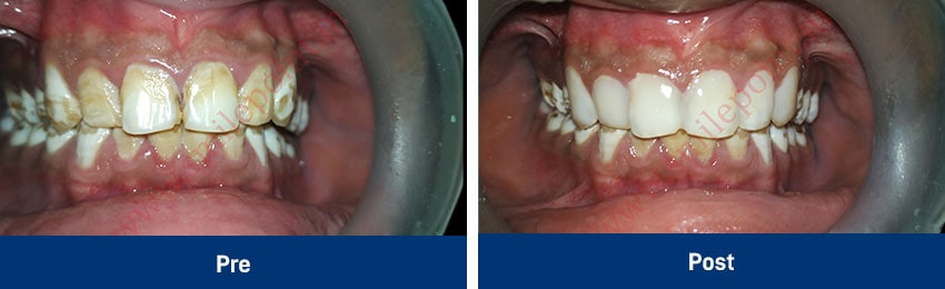 Aesthetic procedures