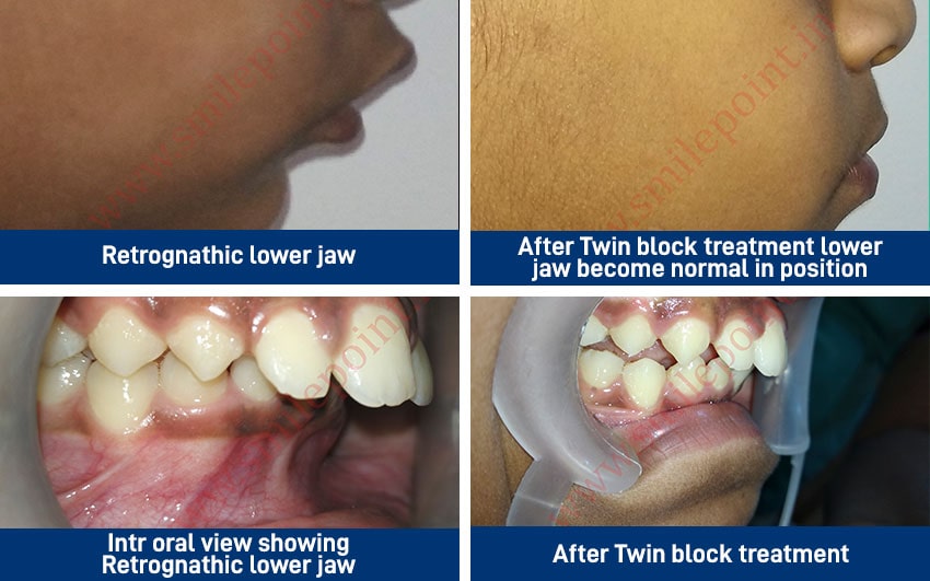 Comprehensive Child care dentistry