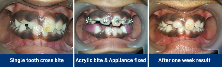 Comprehensive Child care dentistry