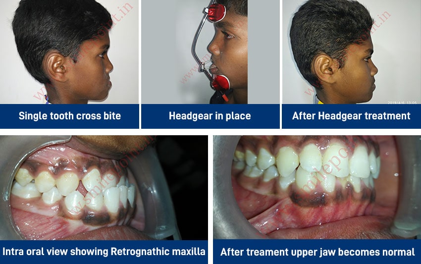 Comprehensive Child care dentistry
