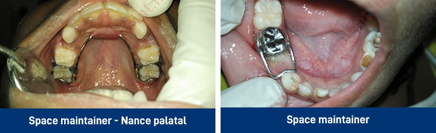 Comprehensive Child care dentistry