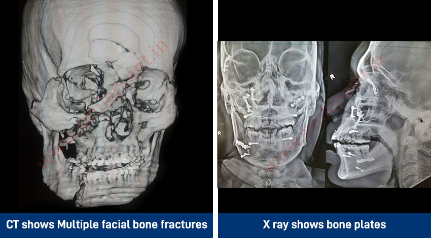 Dental & Facial Trauma Care